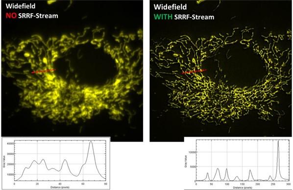 Superresolución SRRF- Stream+ Oxford andor izasa